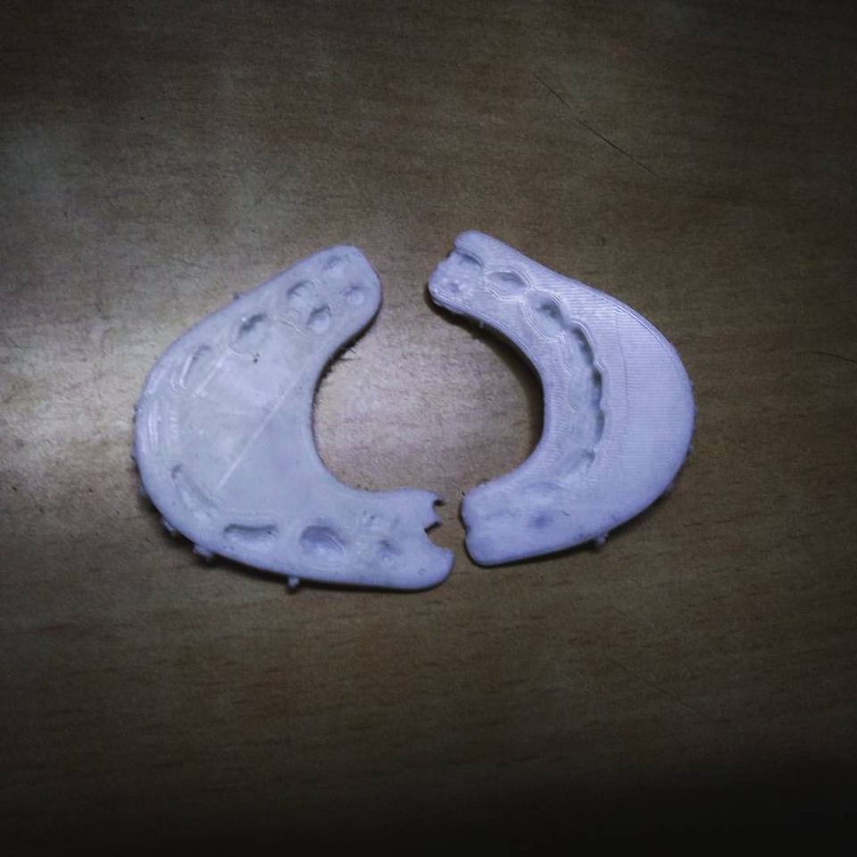 Dental restorations