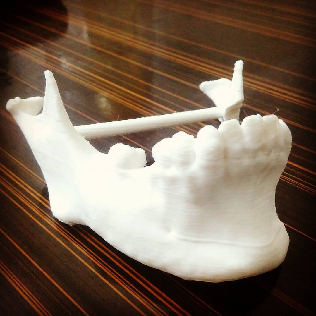 Pre-surgical models