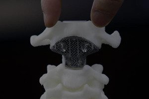 Medical parts